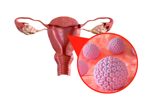 HPV