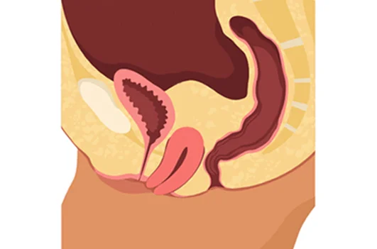 Prolapso Genital