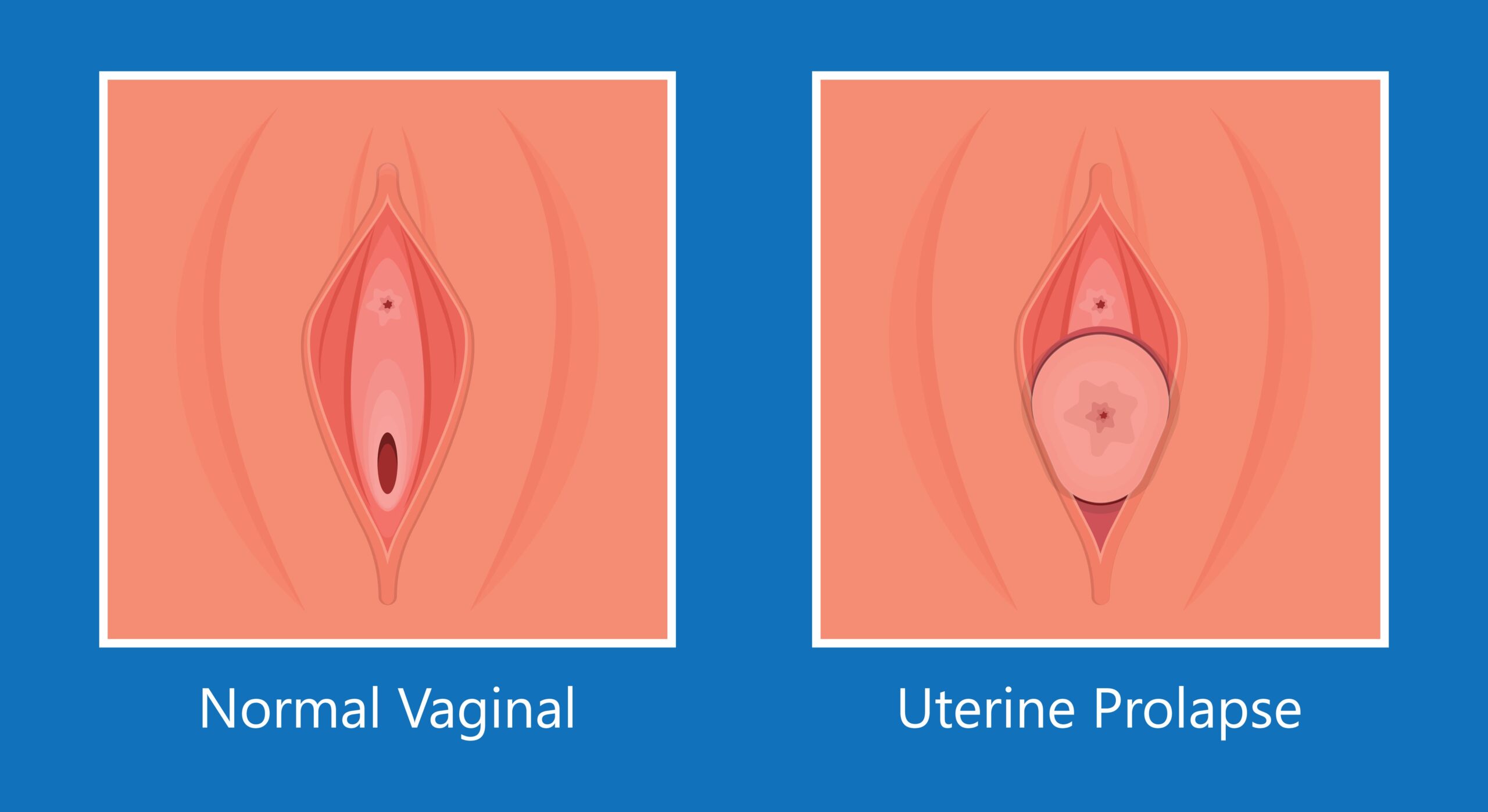 Desenho da vulva