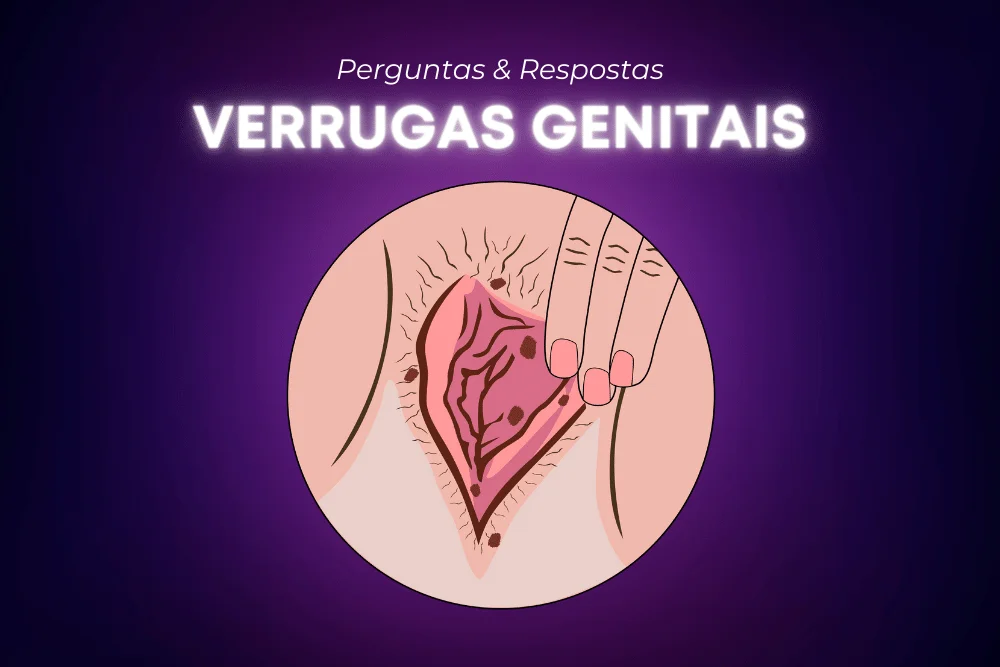 Imagem ilustrativa