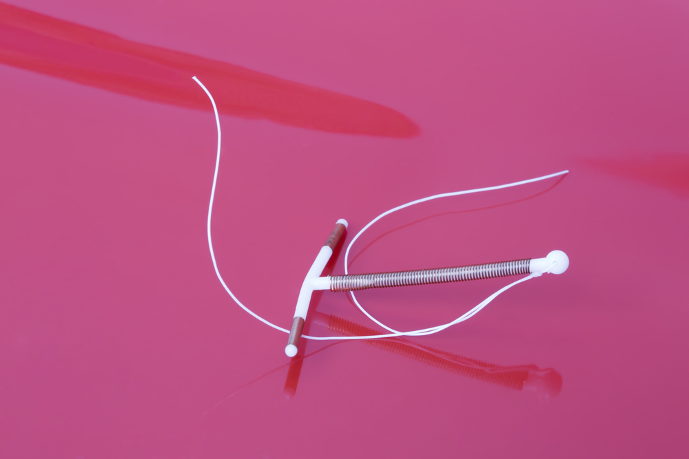 Implantes hormonais