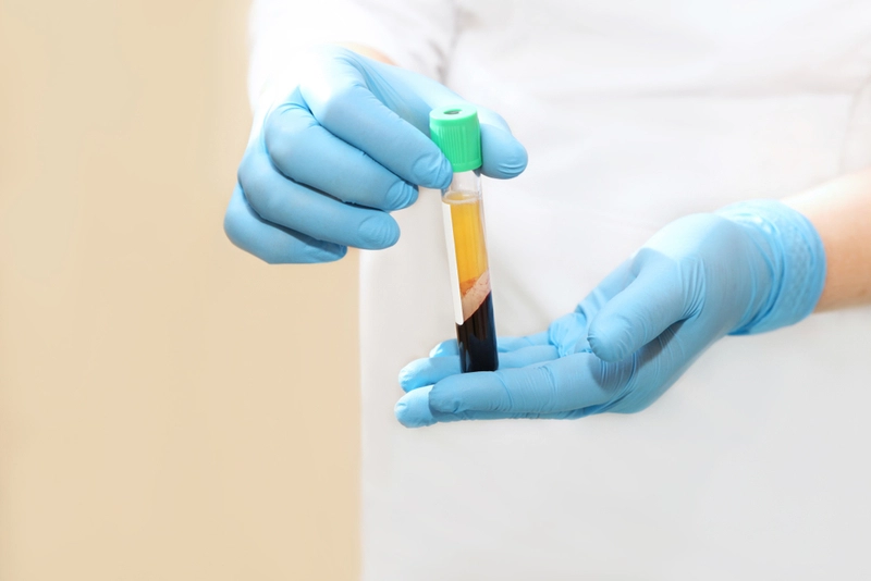 Mãos com luva azul segurando tubo com sangue