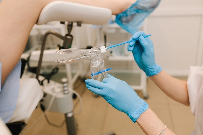 Ginecologista com luvas médicas azuis segura o espéculo vaginal nas mãos.