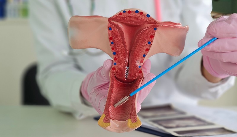 Patologia do Trato Genital Inferior